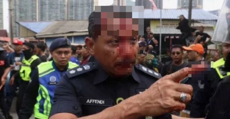Kecoh di Kampung Sungai Baru, Ketua Polis Dang Wangi Cedera Dalam Operasi